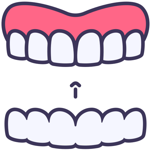 clear aligners