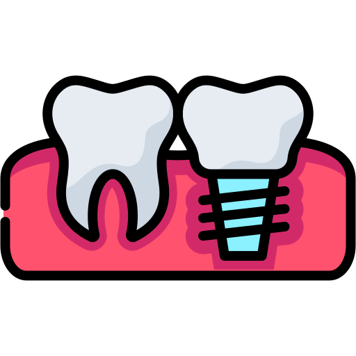 dental-implants